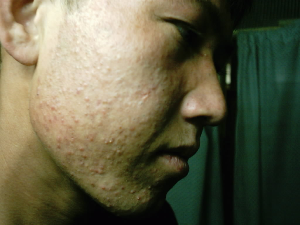 په اروین پوستکي روغتون کې د ځوانک  تخصصي درملنه