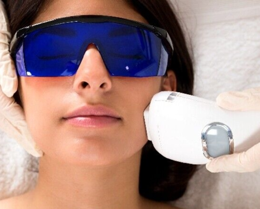 Diode Laser Hair Removal at Arvin Skin Hospil