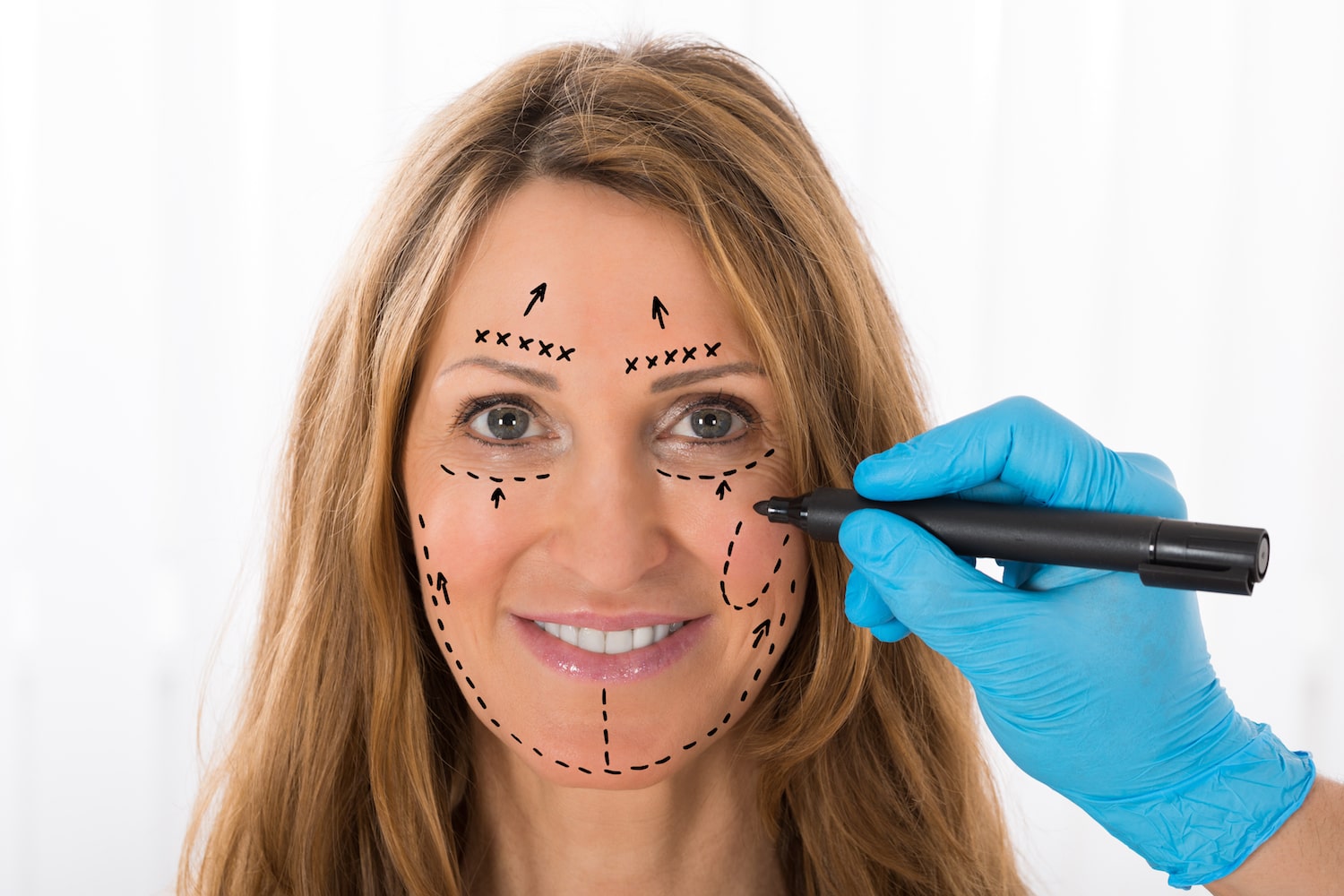 د سترګو د ښکلا جراحي