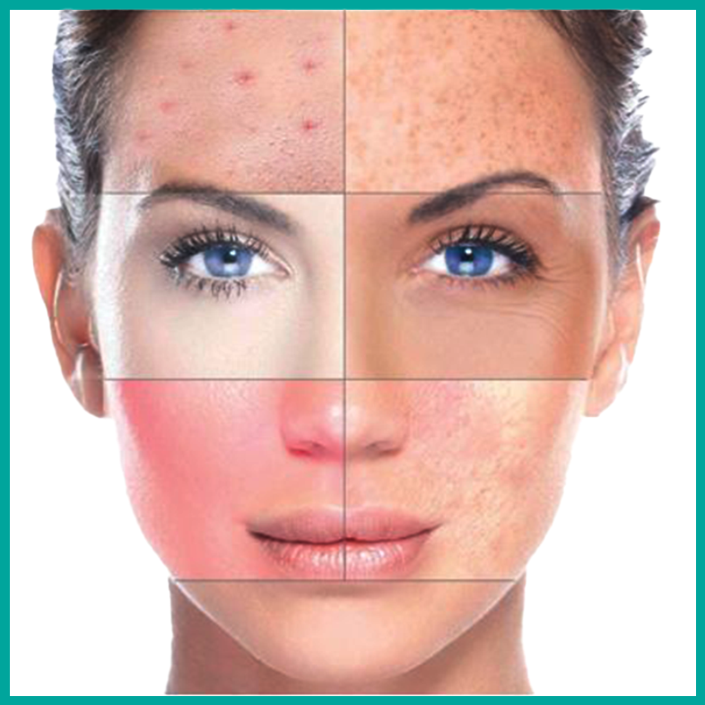 Treatment of skin diseases