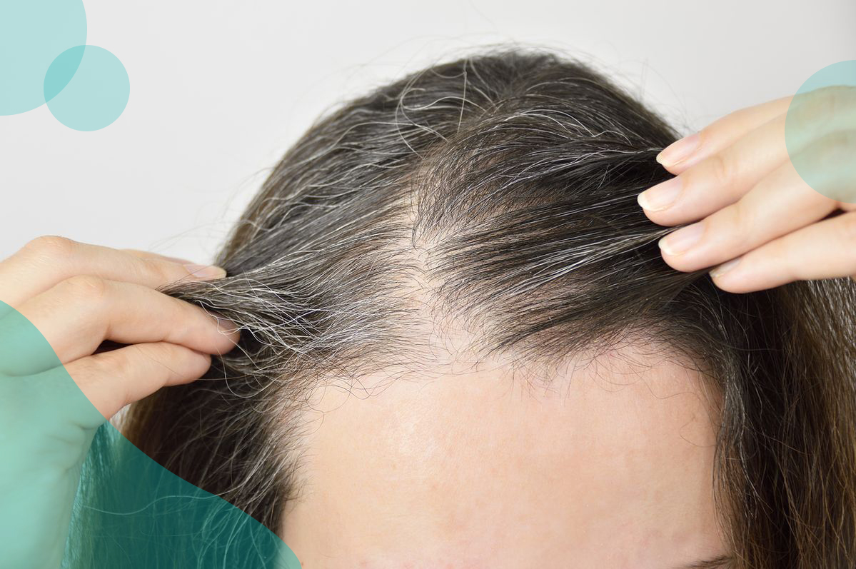 elogen Effluvium Treatment 