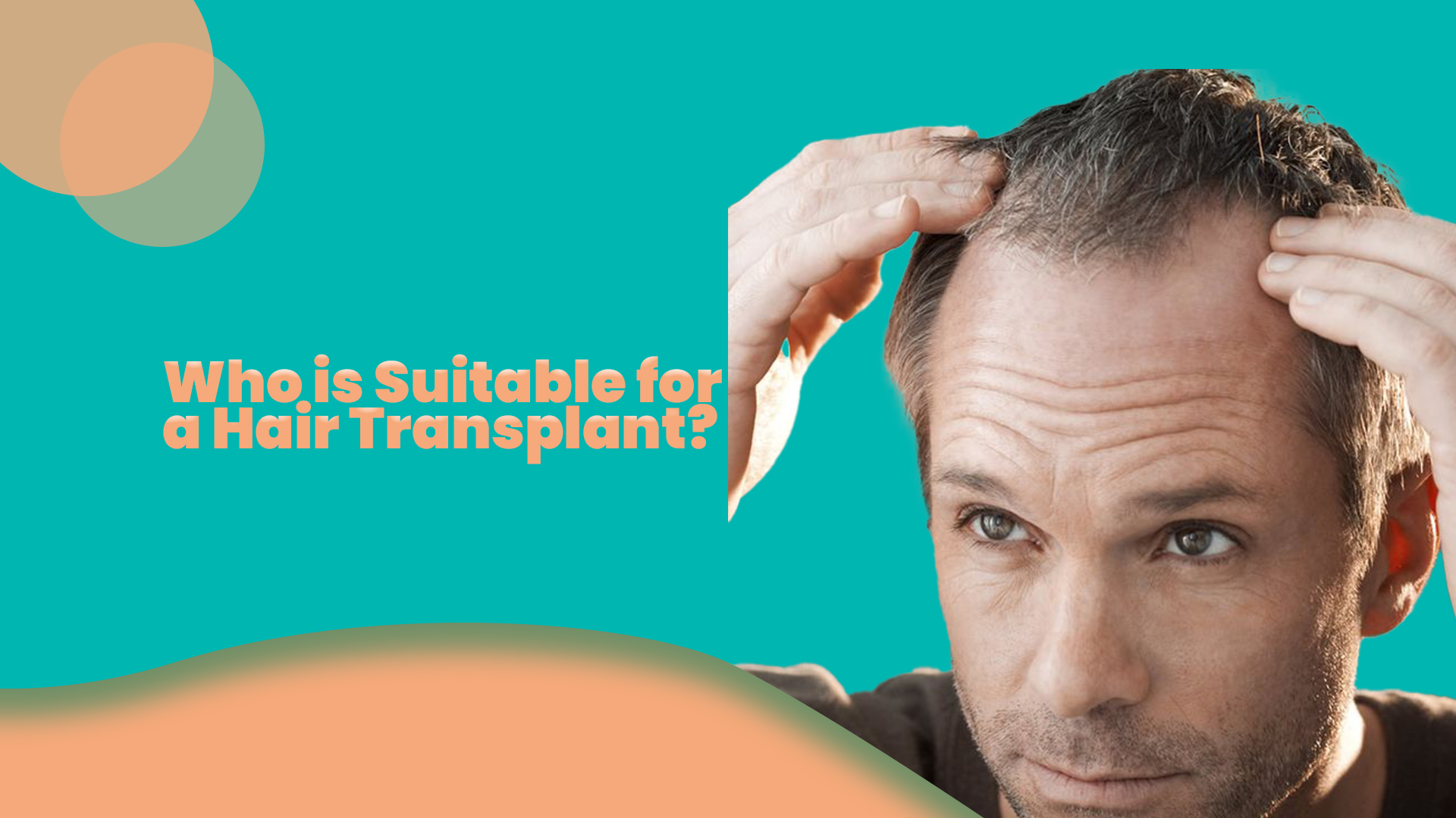 Who is Suitable for a Hair Transplant 