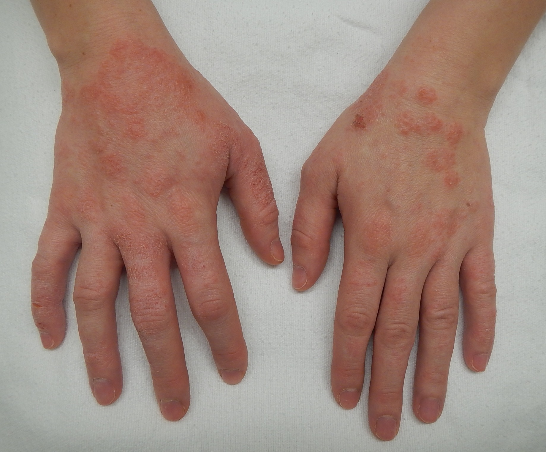 Skin Allergies & Irritations